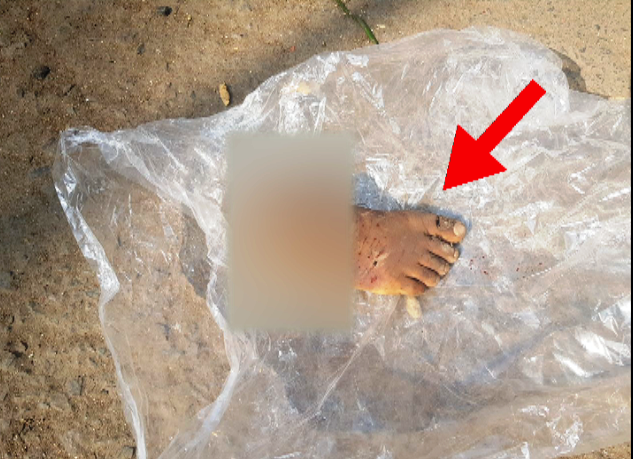 Photo of लखनऊ में सड़क पर कटा मिला पैर का पंजा, इलाके में पसरी दहशत