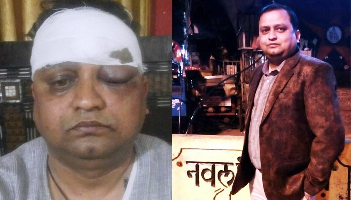Photo of लखनऊ : जानलेवा हमले में पत्रकार की आंख और सिर में आईं गंभीर चोटें