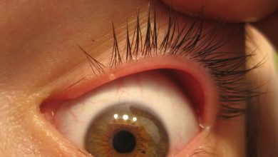 Photo of आंख में पीले धब्बे दिखें तो हो जाइए सतर्क, हो सकता है डिमेंशिया